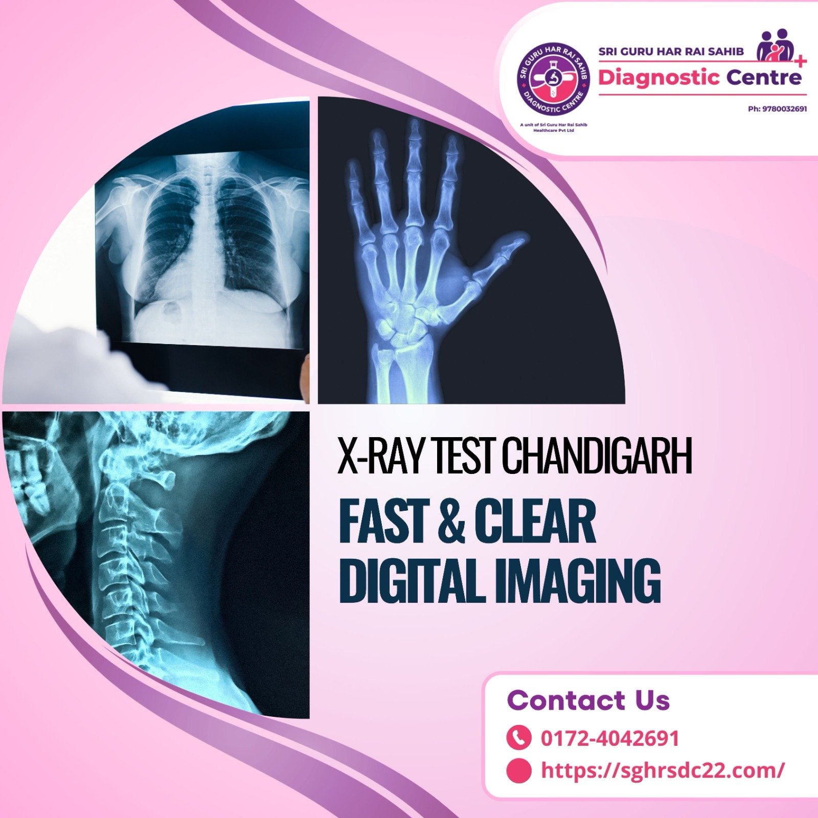 X-Ray Test Chandigarh